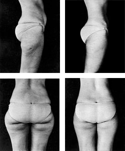 before and after photos